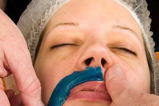 స్త్రీల ముఖంపై అవాంఛిత రోమాలు పోవాలంటే...