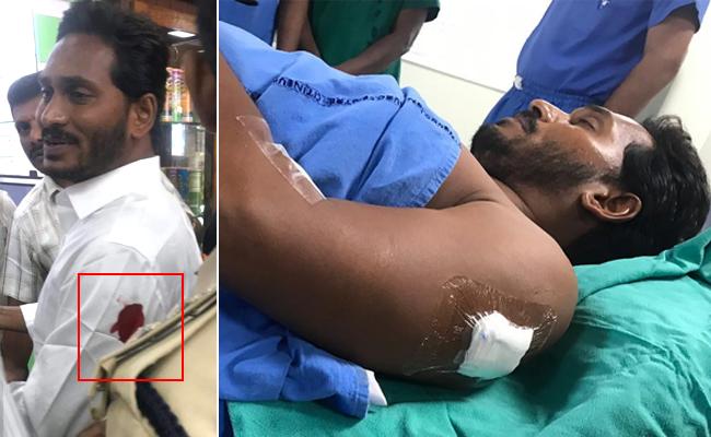 లిఫ్ట్లో జగన్ చెప్పిన మాటలు ఇవే.. లిఫ్ట్లో జగన్ చెప్పిన మాటలు ఇవే..