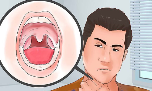 నోటి దుర్వాసనను నివారించే మార్గాలు