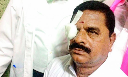 స్వామిగౌడ్ ఇంటికి వెళ్లారు.. మరి కాంగ్రెస్ నేతలు? స్వామిగౌడ్ ఇంటికి వెళ్లారు.. మరి కాంగ్రెస్ నేతలు?