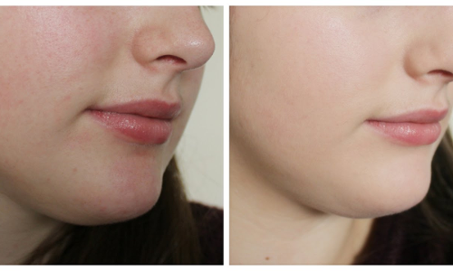 శరీరం అందంగా కనిపించాలా.. అయితే ఇలా..