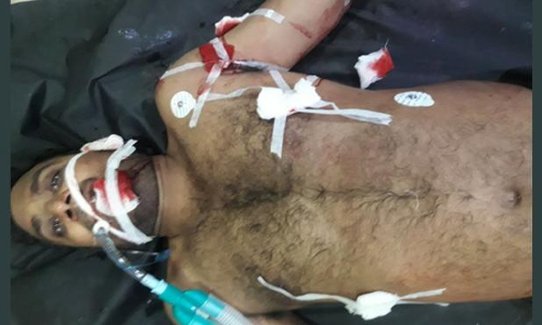 విజయనగరంలో కాల్పులు