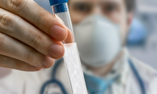 వీర్యకణాల నాణ్యతను పెంచే ఆహార నియమాలు వీర్యకణాల నాణ్యతను పెంచే ఆహార నియమాలు