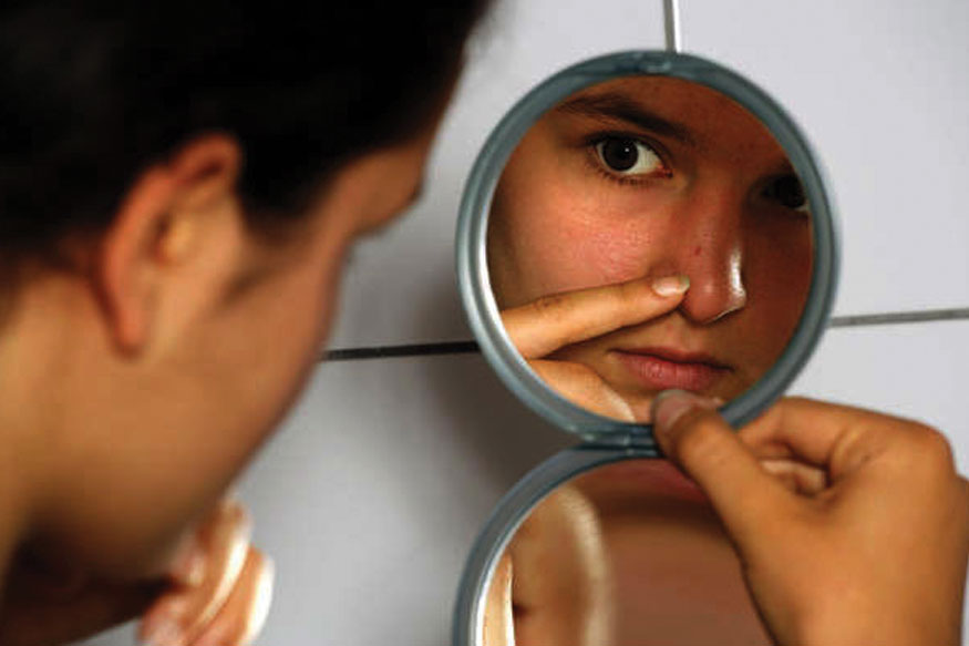 నల్ల మచ్చలకు నేచురల్ రెమెడీస్&nbsp;