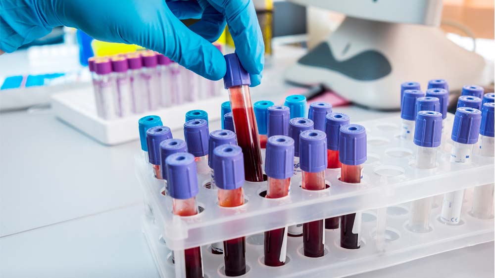 చేరువగా ఉచిత పరీక్షలు