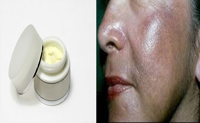 అందం కోసం ఆ క్రీములు వాడుతున్నారా..? ఇక అంతే..