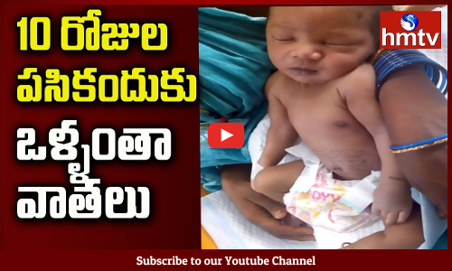 10 రోజుల పసికందుకు ఒళ్ళంతా వాతలు