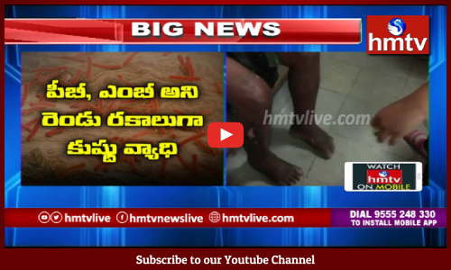 అంతరించిపోయిందనుకున్న కుష్ట మహమ్మరి రాష్ట్రంలో మళ్లీ విజృంభిస్తోంది.